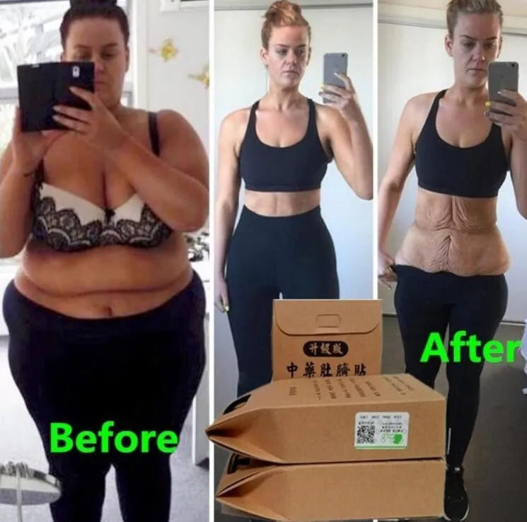 

100pcs Chinese Medicine Slimming Patch Lift Lose Weight Strongest Slim Patch Pads Detox Adhesive Anti Cellulite Face Lift Tool