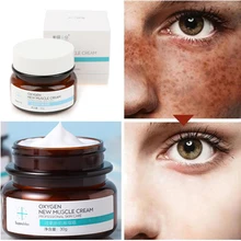 Strong Removal Melasma Whitening Cream Freckle Speckle Spots Melanin Pigment