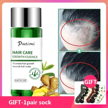 

20ml Ginger Serum Fast Hair Growth Essence Treatment Prevent Hair Loss Products Regrowth Dense Hair Care Essence for Women Men