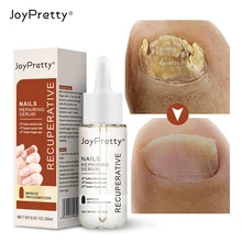 

JoyPretty Nail Fungal Treatment Serum Nail Foot Onychomycosis Paronychia Anti-Fungal Toe Fungus Removal Gel Essence Feet Care