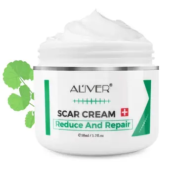

For the face body old and new scars from cuts stretch cream surgeries advanced removal scar natural marks treatment c-secti D5B4