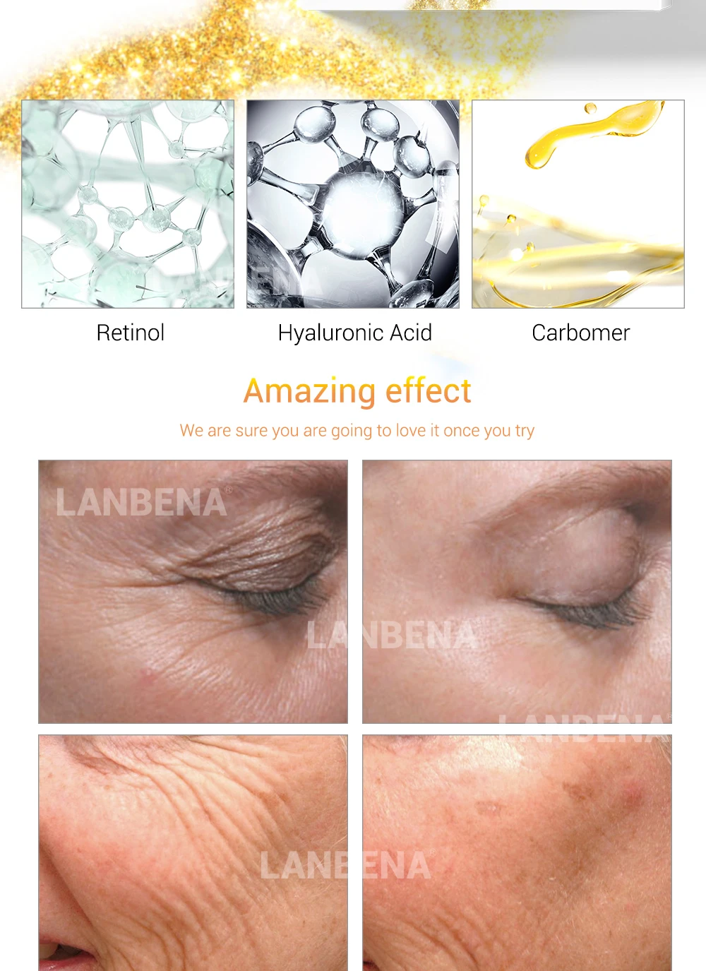 HTB1Cq8WolmWBuNkSndVq6AsApXar