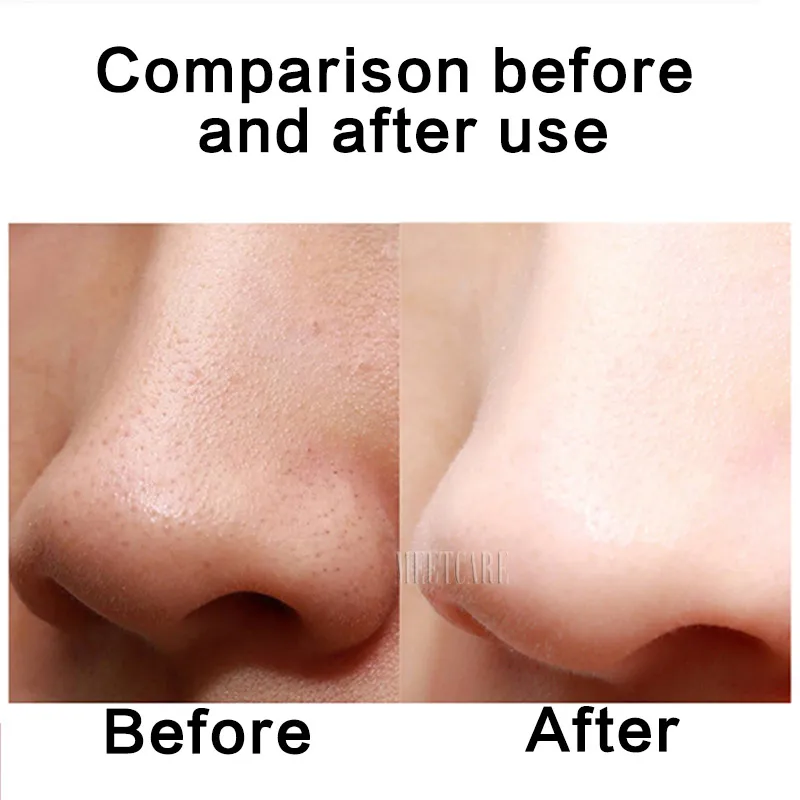 铲皮机7C-CPY-01_07