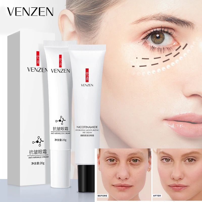 

20ml Niacinamide Eyes Cream Moisturizing Anti Puffiness Remove Dark Circles Eye Bags Cream Anti-Wrinkles Aging Gel Skin Care