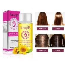 20 мл травяные волосы против выпадения, жидкость, стимулирующая рост густых и быстрых волос, эфирное масло, забота о здоровье, красота, эссенция