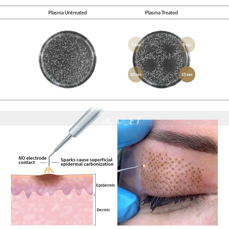 Струя fibroblast плазменная ручка для подтяжки лица деликатная машина удаления пятен