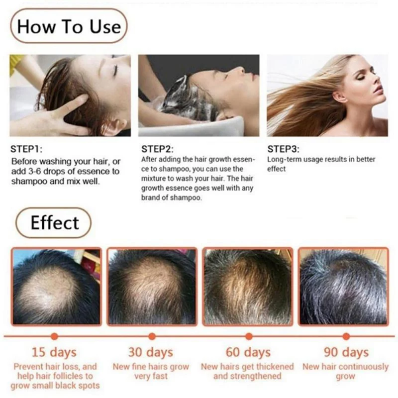 Оптовая торговля лечение роста волос имбирь и растение против выпадения эфирные