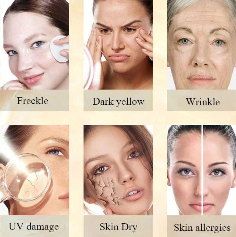 CHUMOLEE арбутин 5% крем для отбеливания веснушек + Kojic кислоты сыворотка выцветает