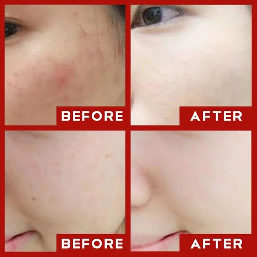 CC Cream Concealer Mushroom Head Air Cushion Isolation Liquid Foundation Waterproof Brightens Concealer Moisturizing Oil Control 5