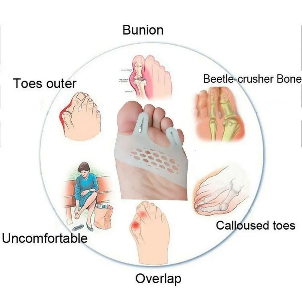 1Pair Hallux Valgus Orthotics Bone Thumb Corrector Big Toe Separators Aligner Toes Support Bunion Straightener Foot care