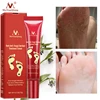 Foot Care Cream Foot spa Pedicure Herbal Detox Anti Fungal Infection Onychomycosis Fungus Treatment   For legs ► Photo 2/6