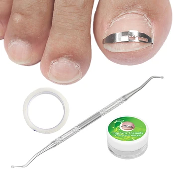 

1Set Ingrown Toenail Correction Tool Ingrown Toe Nail Treatment Inset Buckle Pressure Sensitive Tape Twillizer Pedicure Tool