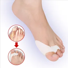 2 pçs silicone gel polegar corrector joint pouco toe protetor separador hallux valgus dedo alisador de cuidados com os pés alívio almofadas