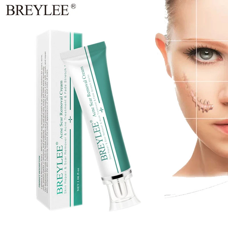 breylee acne scar removal cream