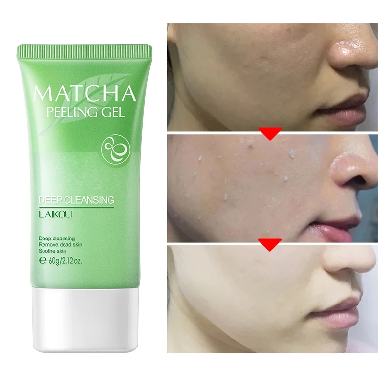 Matcha Gel Exfoliante para el cuidado de la piel, exfoliante Facial Suave de 60g, Control de aceite corporal, limpieza de poros, tratamiento para acné, eliminación de espinillas, exfoliación Facial