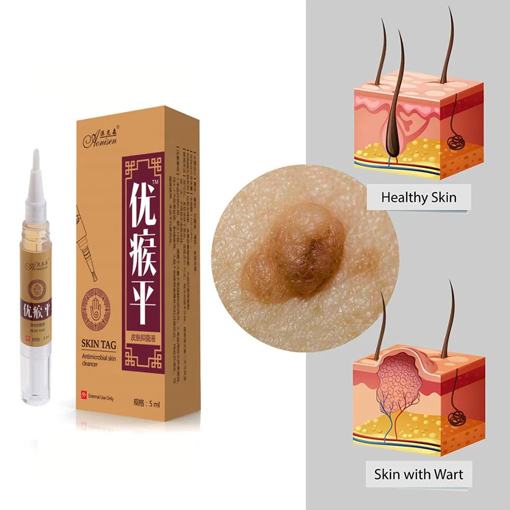 H49a329636c9449a0898d13a2084894f5O