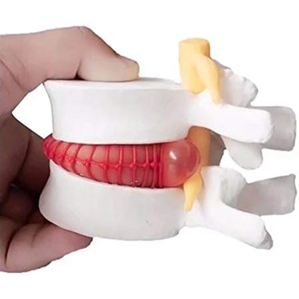 1 шт. анатомический Поясничный диск грыжа поясничного отдела позвоночника модель белого цвета BJStore