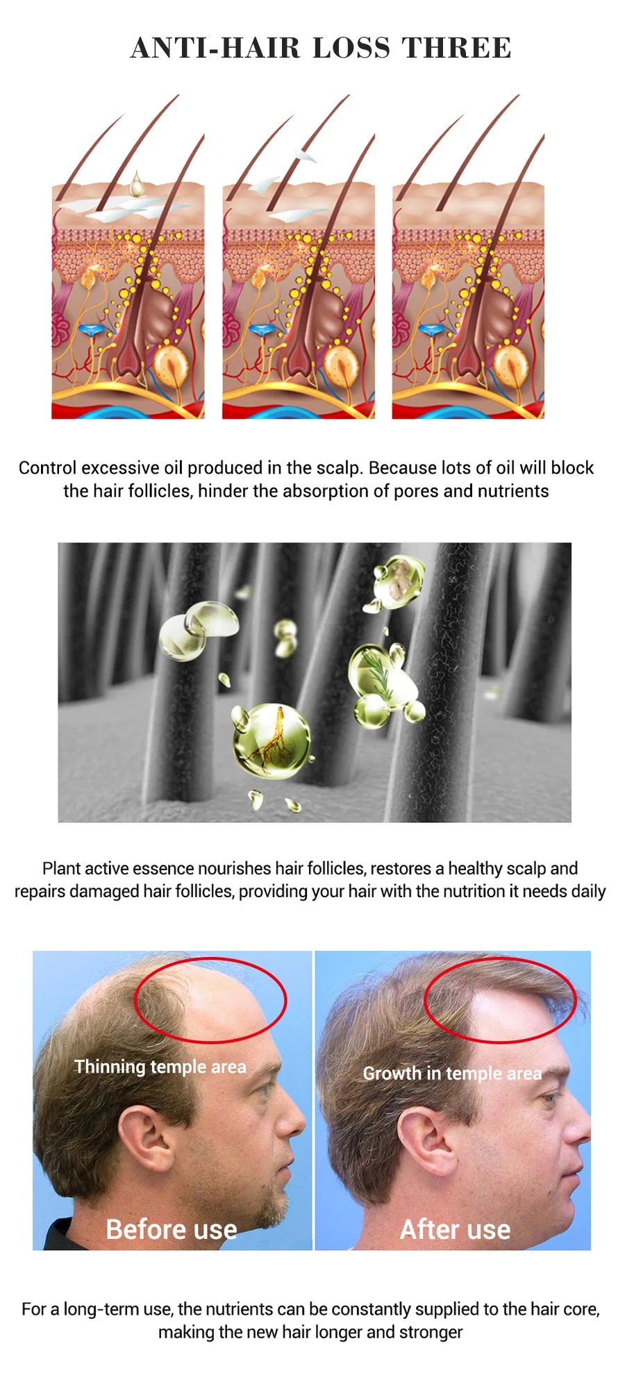 Tratamento do Cabelo do Soro do Óleo Essencial do Crescimento do Cabelo do Gengibre Perdidos da Beleza Rapidamente o Reparo do Couro Cuidados com o Cabelo Anti Produtos Cresce Cabeludo Frisado Danificado 5 Prod. perda cab. masc.