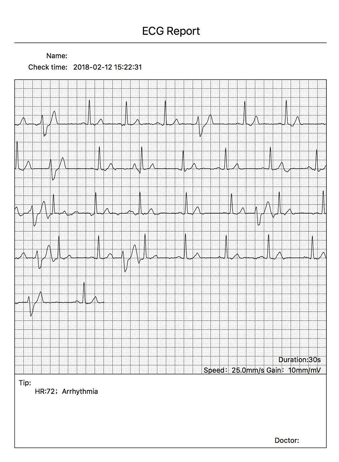 Handheld Portable ECG EKG Machine Heart Beat Monitor LCD USB Bluetooth + Free Software