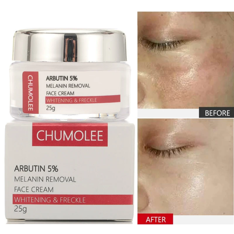 *chumolee Alpha Arbutin Whitening Freckle Face Cream Melasma Remove