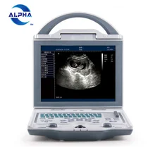 

china Health care medical ultrasound machine