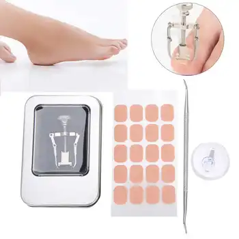 

Stainless Steel Ingrown Toenail Corrector Dead Skin Fork Toenail Correction Patch Buckle Set Toenail Correction Kits Therapy