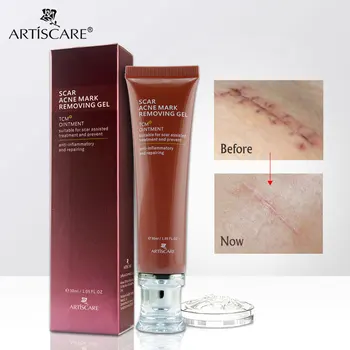 

ARTISCARE Scar Acne Mark Removing Gel TCM Blackhead Treatment Repair Skin Whitening Smooth Soft Face Cream Skin Care Ginseng Tea