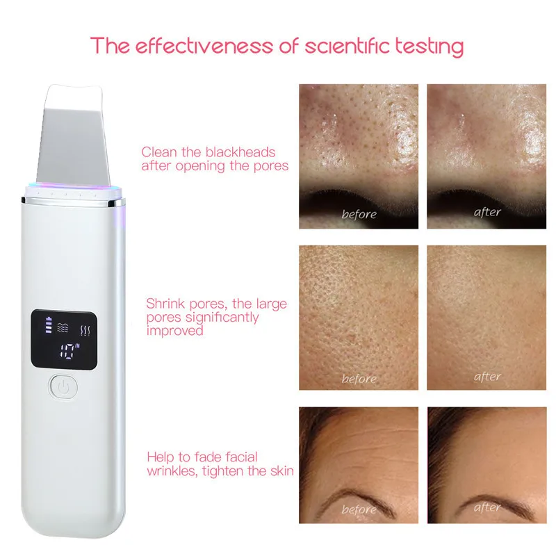 Ultrasonic Face Cleaning Peel Machine Skin Scrubber Blackhead Remover Reduce Spots Facial Cleaner Whitening Lifting Massager