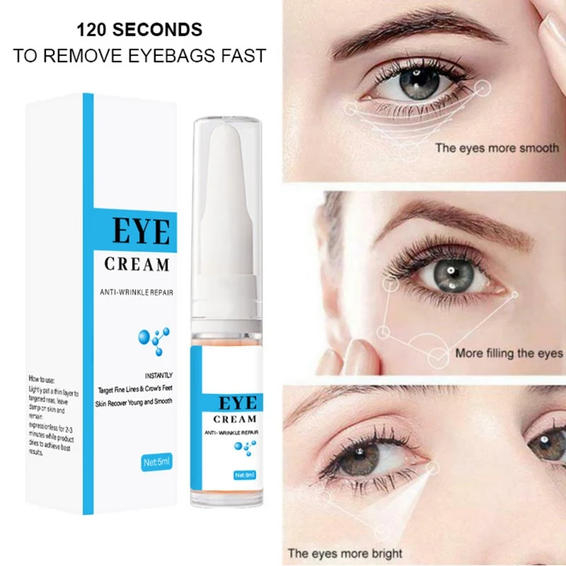 fine lines under eyes at 23