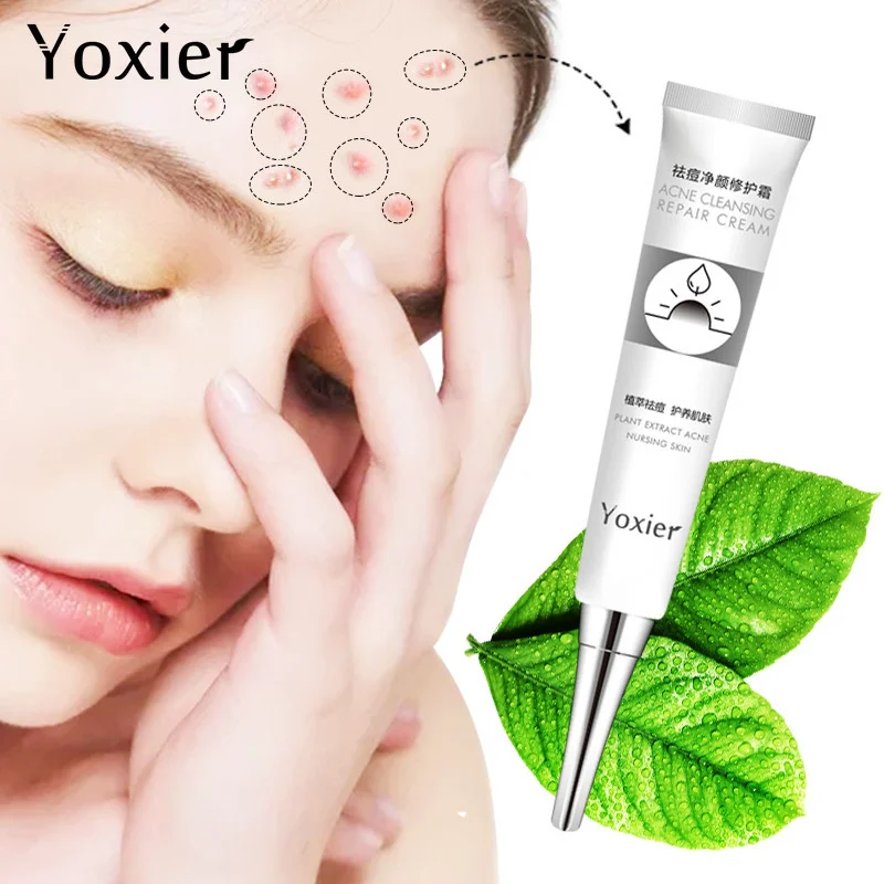 Крем Yoxier для ухода за кожей лица от акне и черных точек 20 г | Красота здоровье