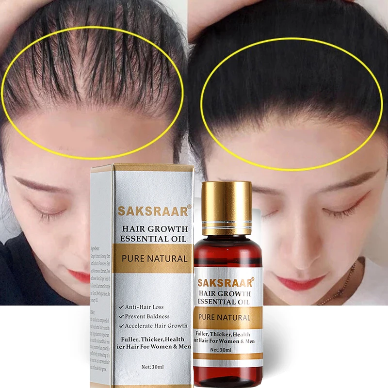 Cuidado del cabello para el crecimiento del cabello aceites esenciales esencia Original auténtico 100% pérdida de cabello líquido salud belleza suero denso para el crecimiento del cabello