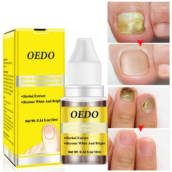 

OEDO Effective Natural Essence Oil Nail Liquid Repair Treatment Nail Toe Fungus Removal Moisturizing Nail Foot Care 10ML TSLM2