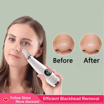 

Electric Vacuum Blackhead Black Dot Remover Face Pore Skin Care Acne Pore Cleaner Pimple Removal Vacuum Suction Facial Tools