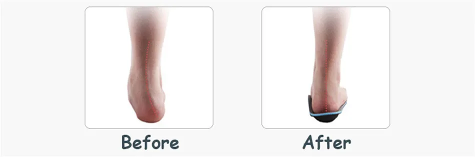 orthopedic insoles (5)