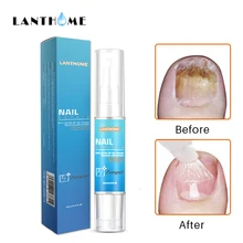 Средство для лечения грибковых ногтей, жидкое отбеливание ногтей и ног, удаление грибка, уход за ногами, гель для ногтей, набор для макияжа, Масло для кутикулы