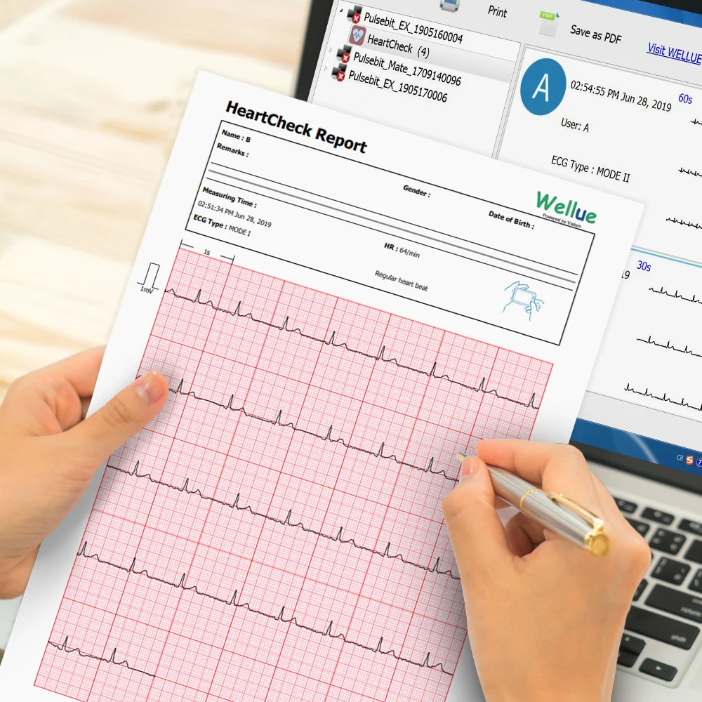 ЭКГ/ЭКГ монитор сердца для аритмии Afib 30 s-5 мин Измерение Поддержка Leadwire Bluetooth бесплатное приложение ПК отчет, Wellue Pulsebit EX