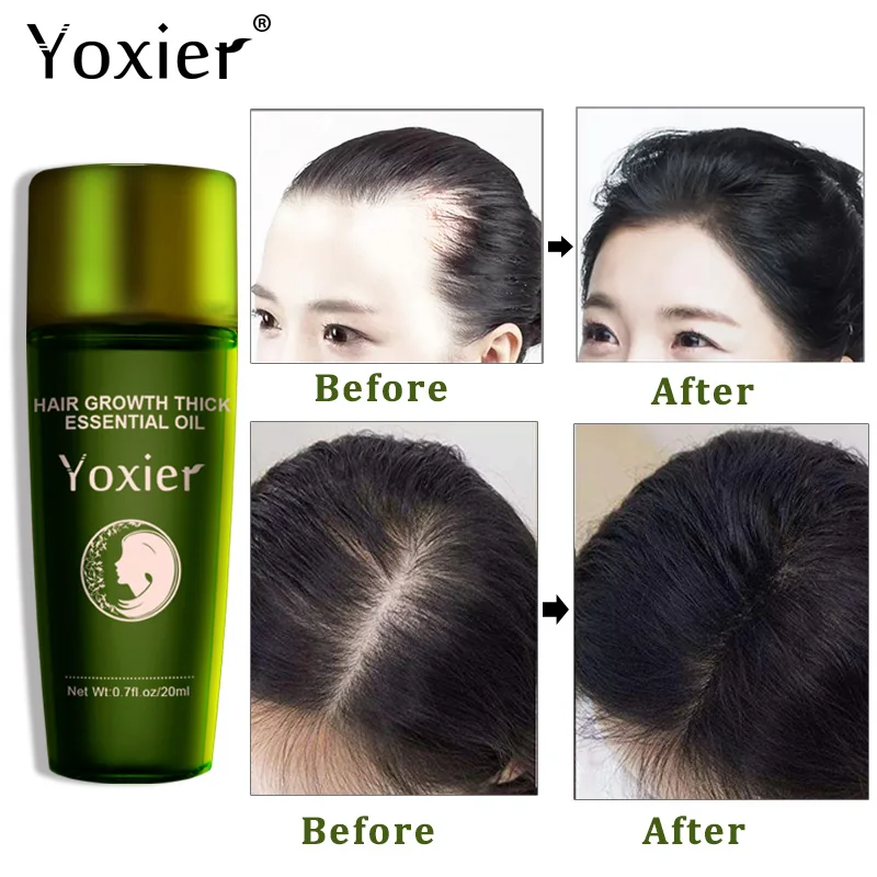 

Hot sale Fast Hair Growth Essence Fast Powerful Hair Loss Product Beard Oil Growth Serum Oils Hair Growth Treatment Hairs Care