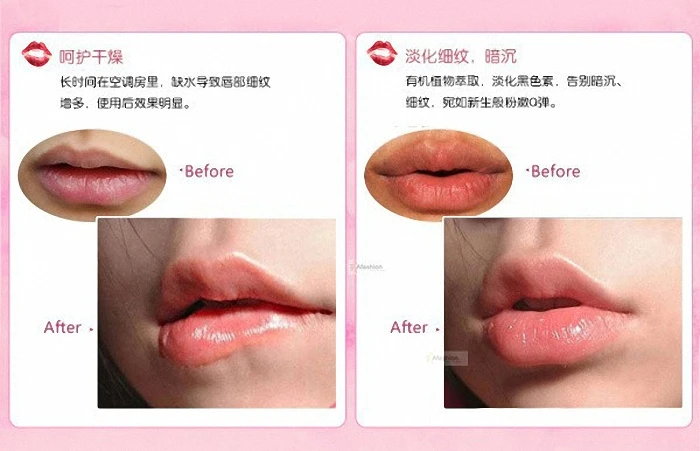 lip (2)