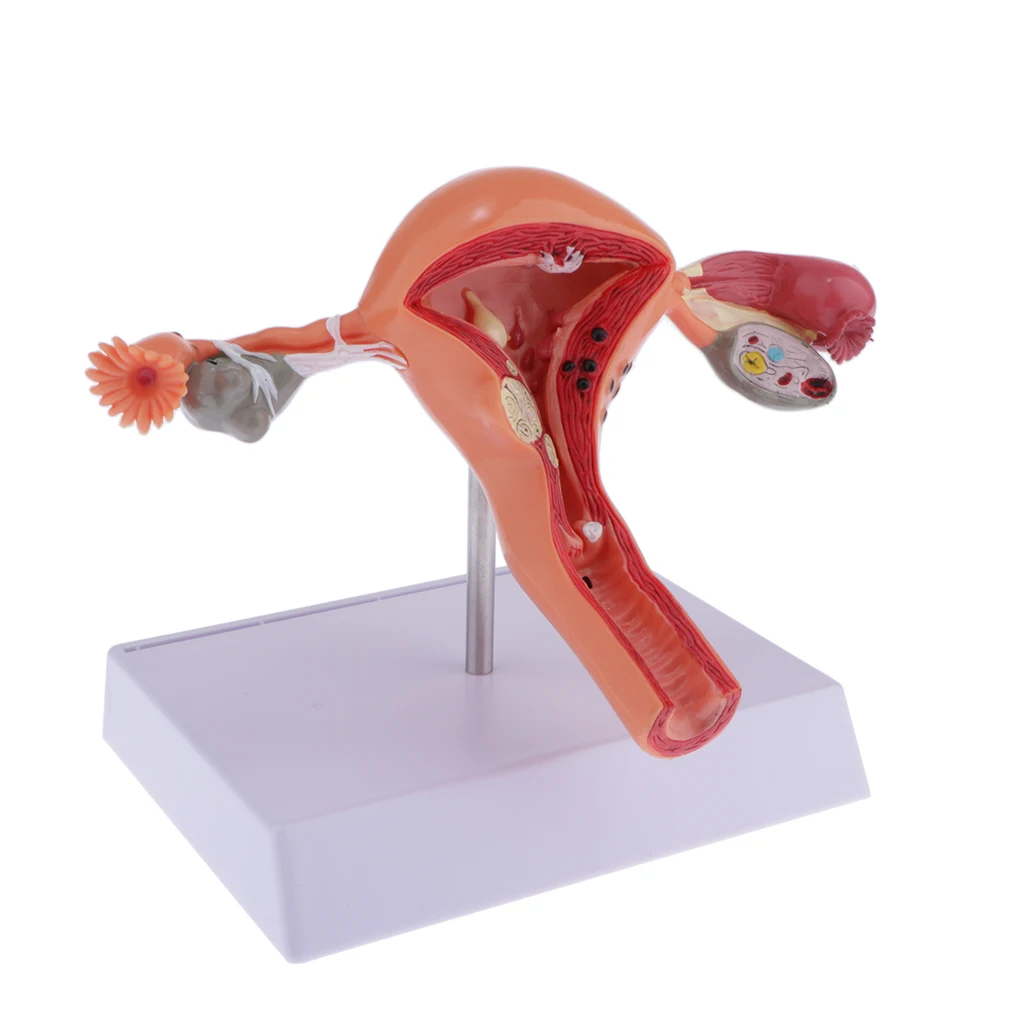 Human Female Uterus Ovary Anatomical Model With Pathologies, 1:1 Life Size, Lab Supplies Decoration