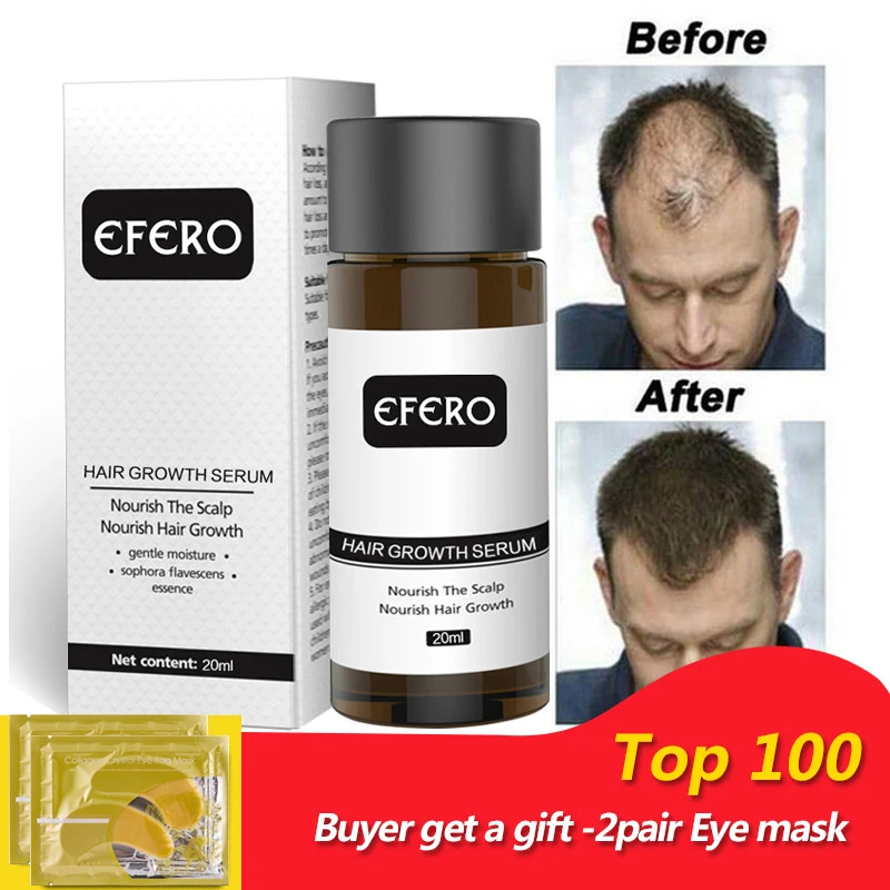 Powerful Fast Hair Growth Serum Essential Oil Anti Preventing Hair Lose Serum Professional Hair Repair Growing Essence for Women