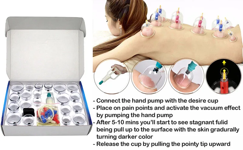 MHKBD 12/24pcs/set Vacuum Cupping Device Suction Cups