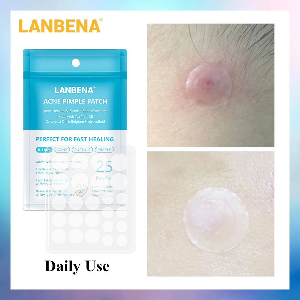 

Lanbena Pimple Patch 25pcs Daily Use Invisible Stickers Blemish Treatment Acne Master Face Mask Beauty Tool Skin Care