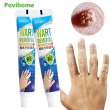 1/3pcs 20g Warts Remover Antibacterial Ointment Wart Treatment Cream Body Skin Tag Wart Dark Spot Remover Plaster Warts Ointment