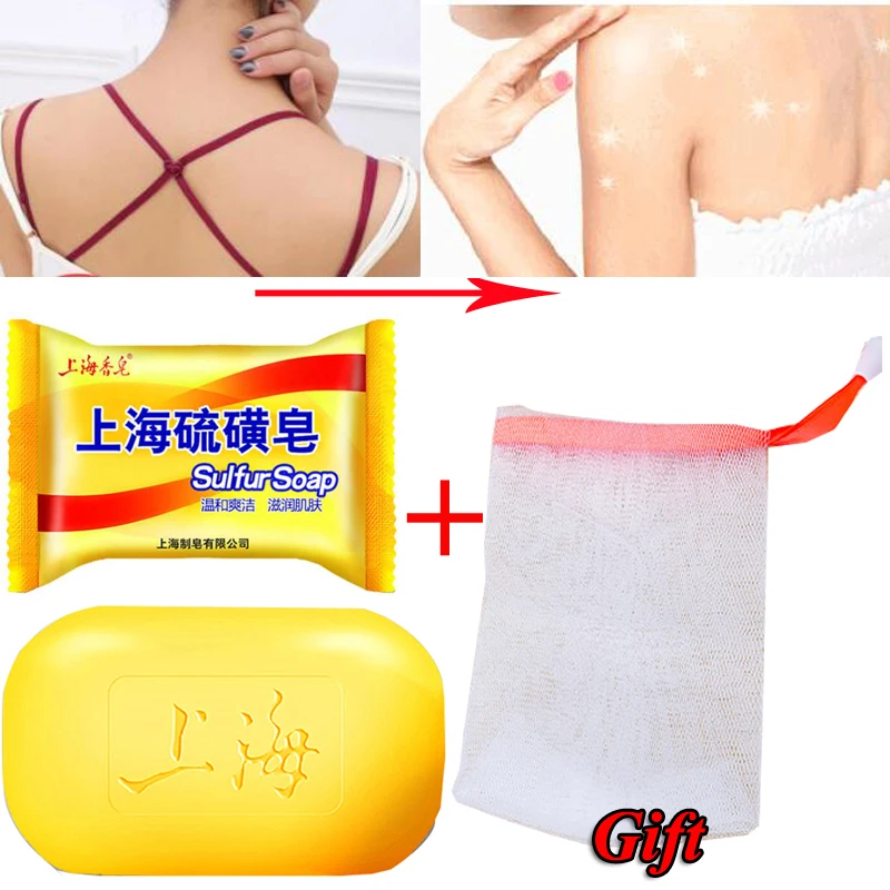 Sulfur Soap Whitening-Cleanser Skin-Care Acne-Treatment Lackhead-Remover Shanghai Chinese