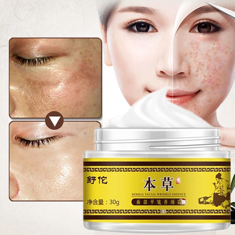 Whitening Freckle Cream Facial Removal Face Care Repair Remove Dark Spots Remover Cream Brightening Treatment Skin Care Sets Kits Aliexpress