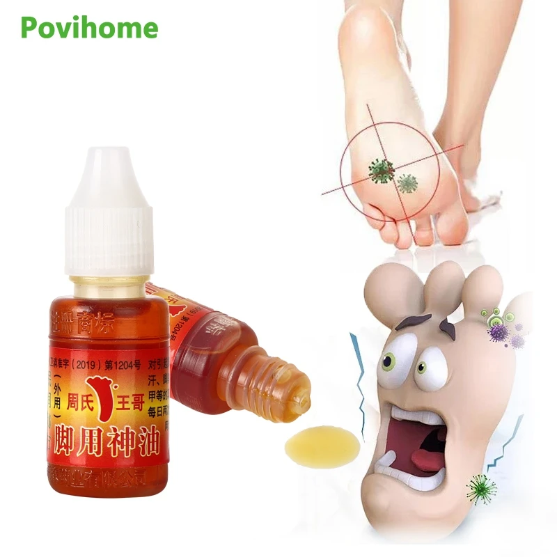 

10ml Foot Beriberi Oil Athlete's Foot Plaster Erosive Beriberi Remove Sweat Odor Psoriasis Peeling Antibacterial Ointment Care