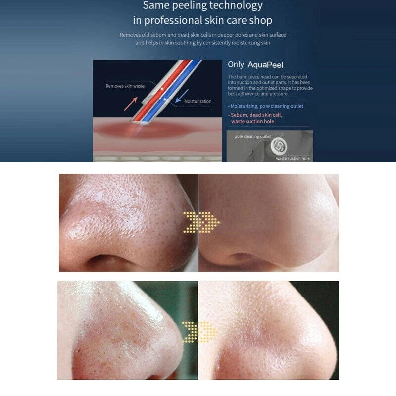 Аппарат для очистки кожуры Hydra Dermabras кислородная струйная очистка водная терапия