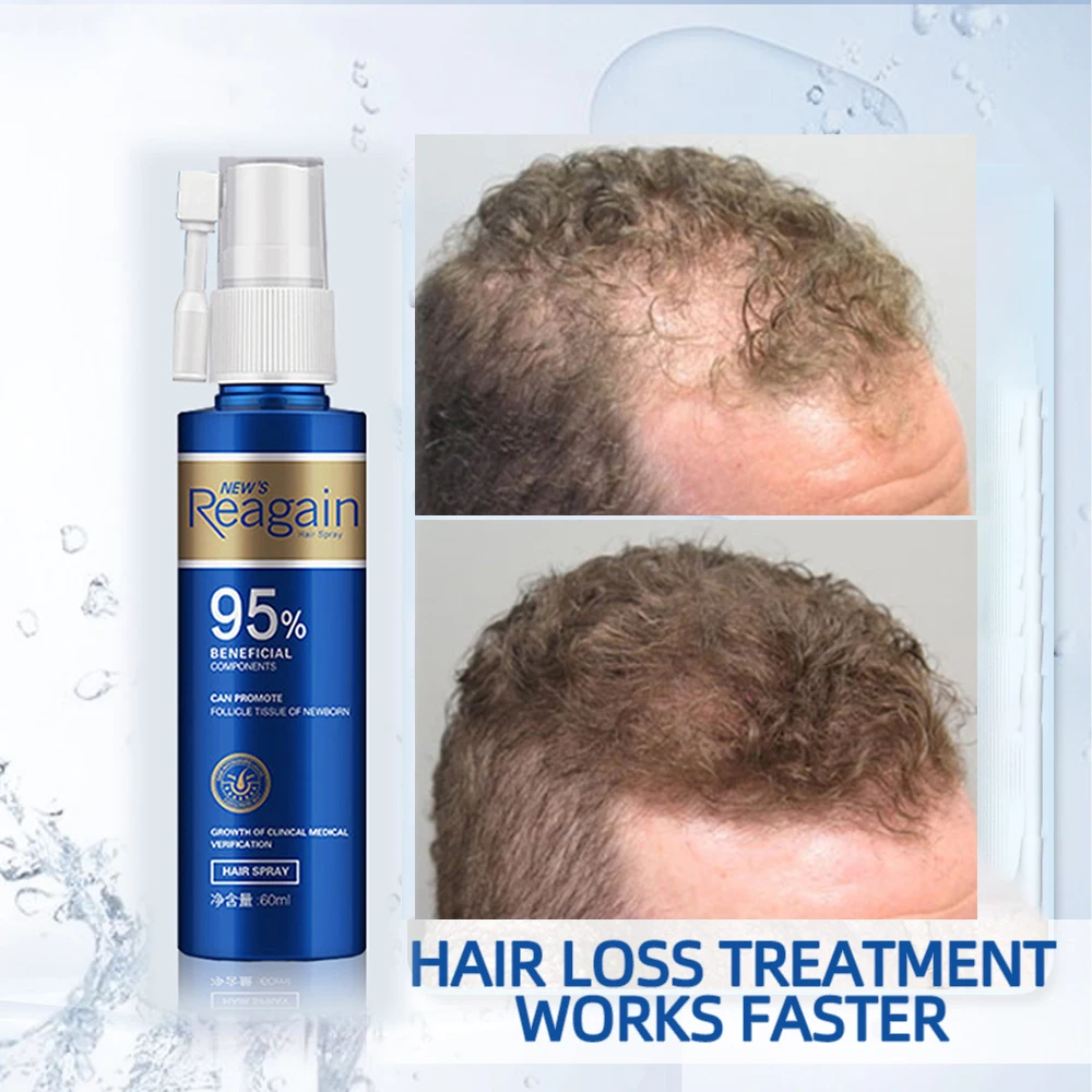 Sale Hair-Tonic Hair-Growth-Products Spray Fine-Hair Men/women for Thick 33mj6A5eqqb