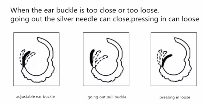 耳圈调整图