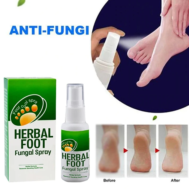 Feet Care Spray Remover Foot Odor Sweat Antibacterial Deodorant